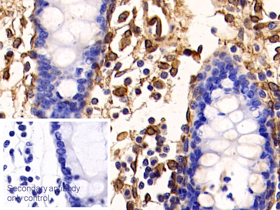 Polyclonal Antibody to Annexin V (ANXA5)