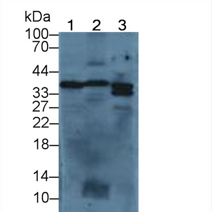 Polyclonal Antibody to Annexin V (ANXA5)