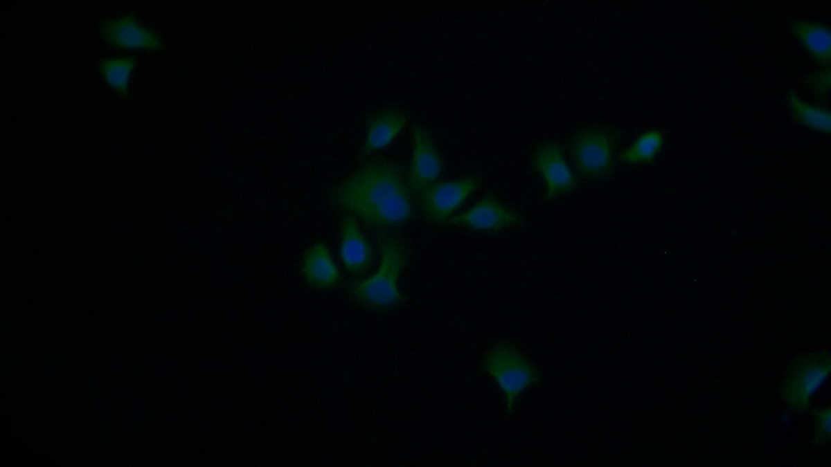 Polyclonal Antibody to Annexin V (ANXA5)