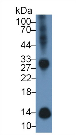 Polyclonal Antibody to Beta-2-Microglobulin (b2M)