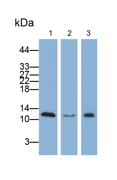 Polyclonal Antibody to Beta-2-Microglobulin (b2M)