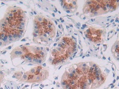 Polyclonal Antibody to Transferrin Receptor 2 (TFR2)