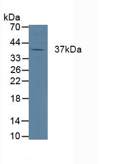 Polyclonal Antibody to Cathepsin K (CTSK)