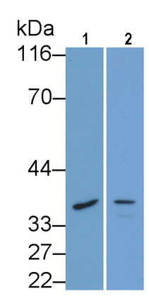 Polyclonal Antibody to Cathepsin K (CTSK)