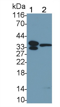 Polyclonal Antibody to Cathepsin K (CTSK)