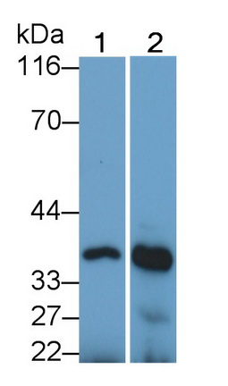 Polyclonal Antibody to Cathepsin K (CTSK)