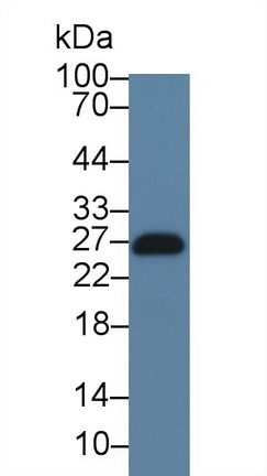 Polyclonal Antibody to Linker For Activation Of T-Cell (LAT)