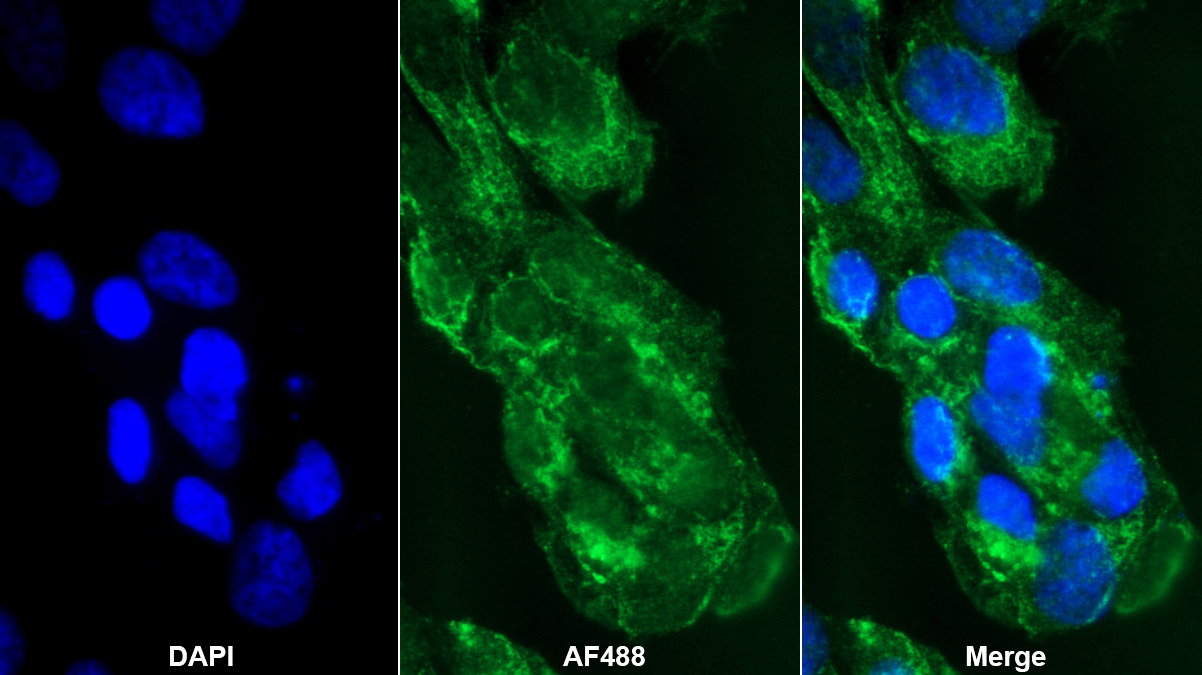 Polyclonal Antibody to Immunoglobulin superfamily, member 1 (IGSF1)