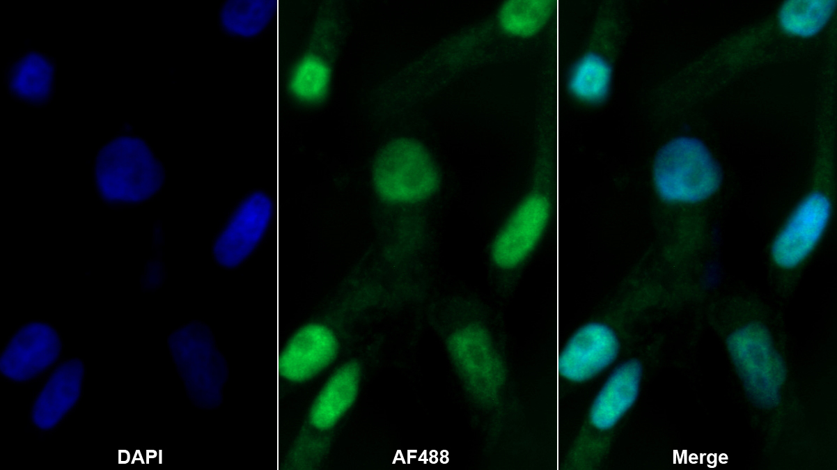 Polyclonal Antibody to Poly ADP Ribose Polymerase (PARP)
