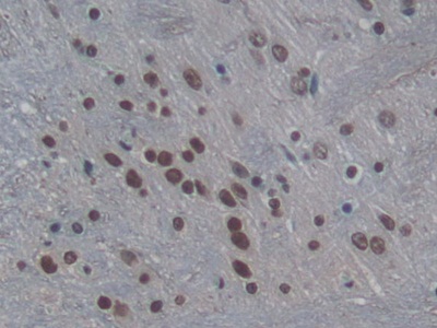 Polyclonal Antibody to Histone H3 (H3)