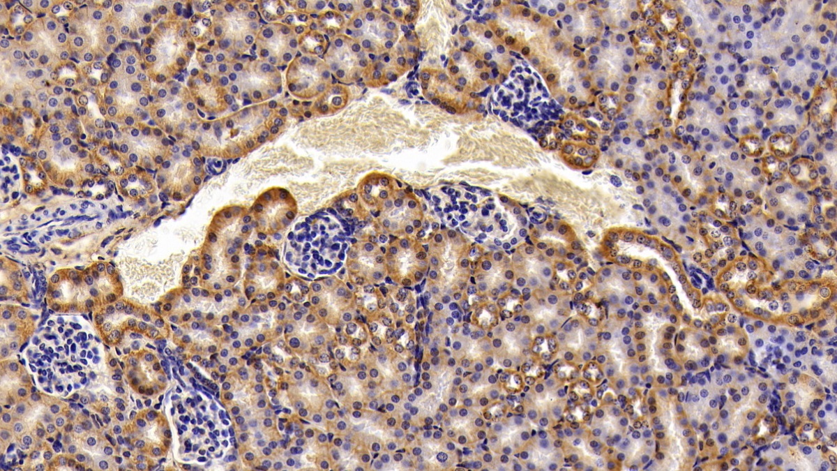 Polyclonal Antibody to Alpha-Fodrin (SPTAN1)