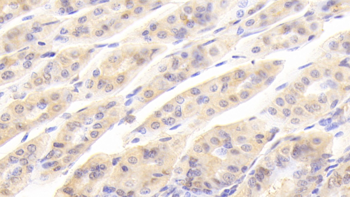 Polyclonal Antibody to Galectin 2 (GAL2)