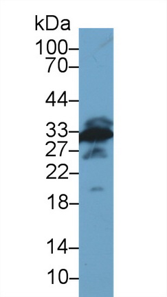 Polyclonal Antibody to Galectin 3 (GAL3)