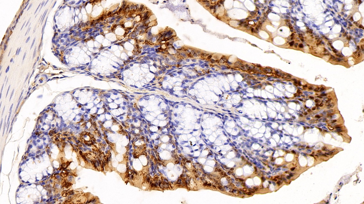 Polyclonal Antibody to Galectin 3 (GAL3)