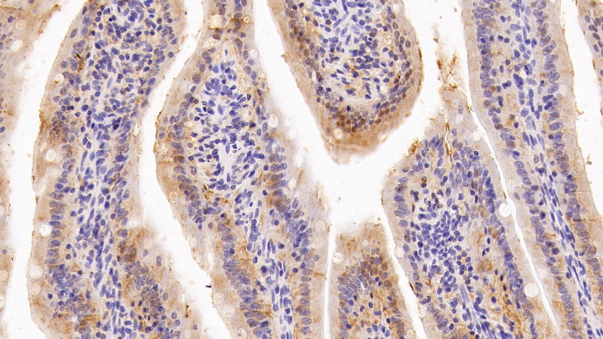 Polyclonal Antibody to Galectin 4 (GAL4)