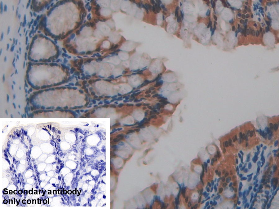 Polyclonal Antibody to Galectin 4 (GAL4)