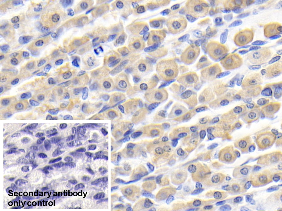 Polyclonal Antibody to Galectin 4 (GAL4)