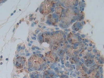 Polyclonal Antibody to Cathepsin L (CTSL)