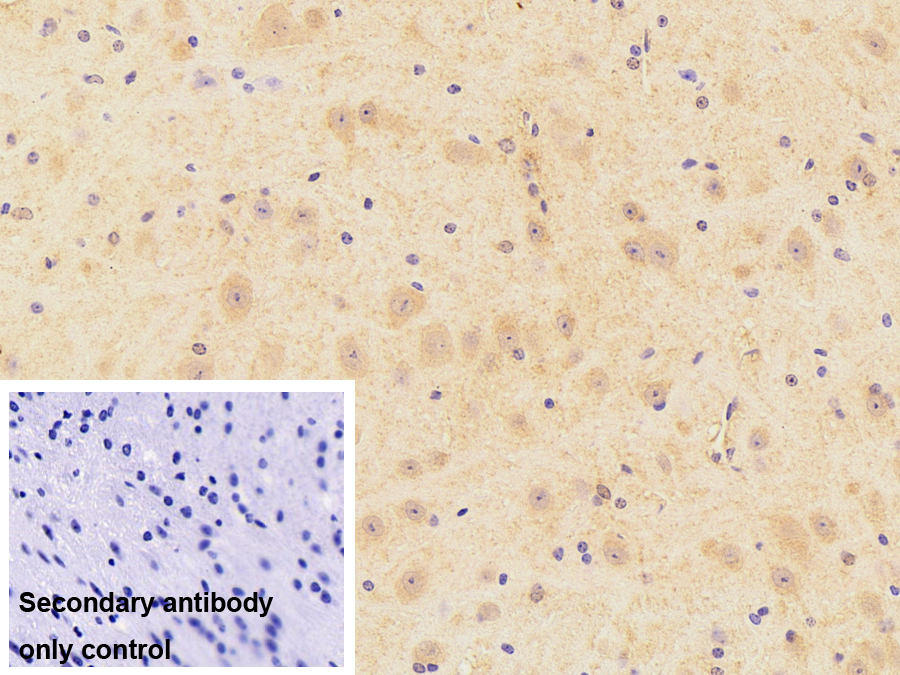 Polyclonal Antibody to Galectin 9 (GAL9)