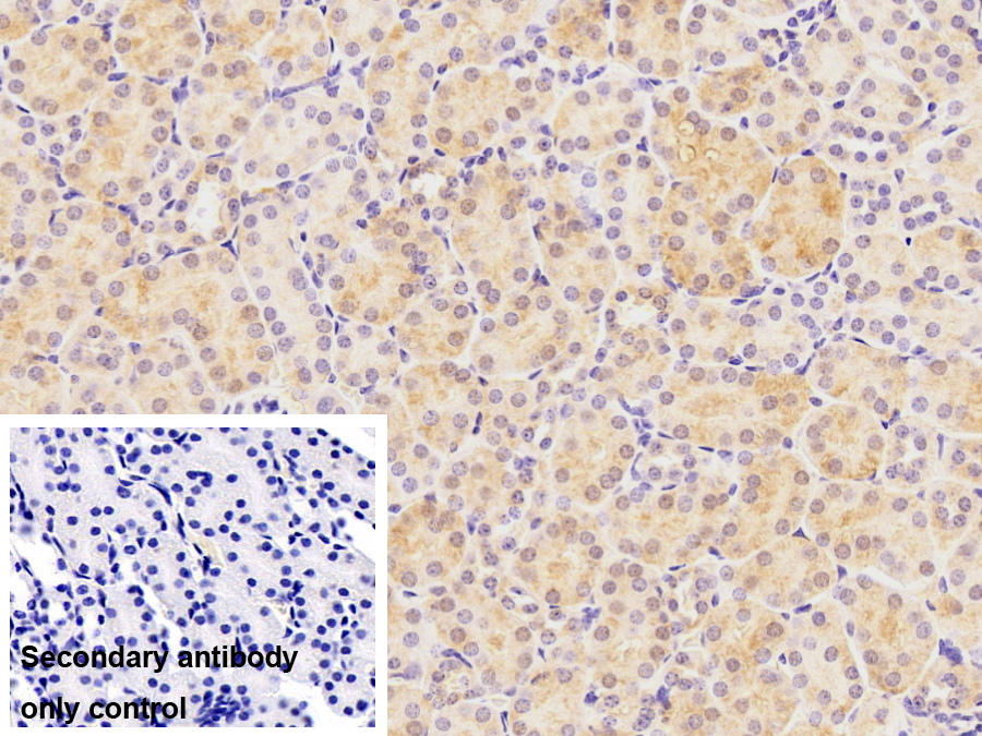 Polyclonal Antibody to Galectin 9 (GAL9)