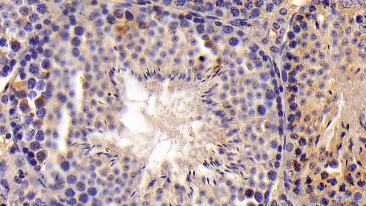 Polyclonal Antibody to Galectin 9 (GAL9)