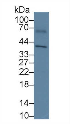 Polyclonal Antibody to Apolipoprotein H (APOH)