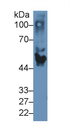 Polyclonal Antibody to Apolipoprotein H (APOH)