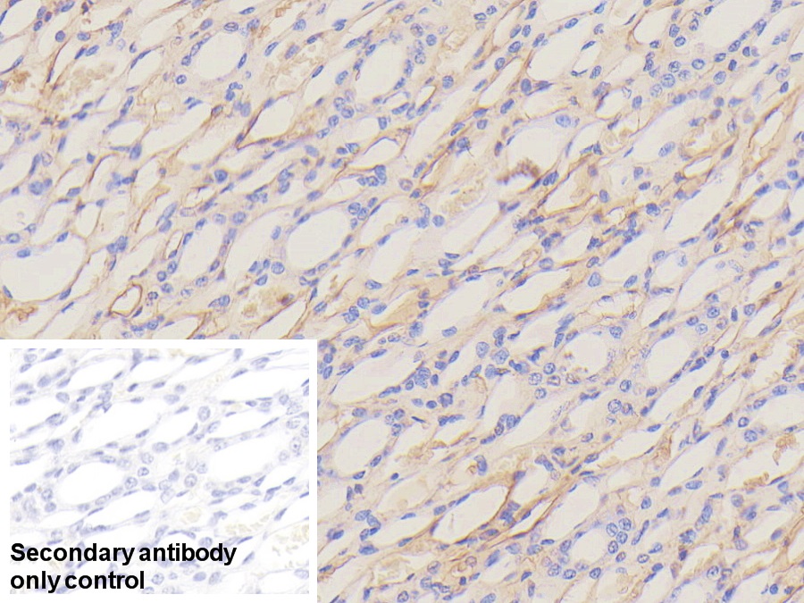 Polyclonal Antibody to Apolipoprotein H (APOH)