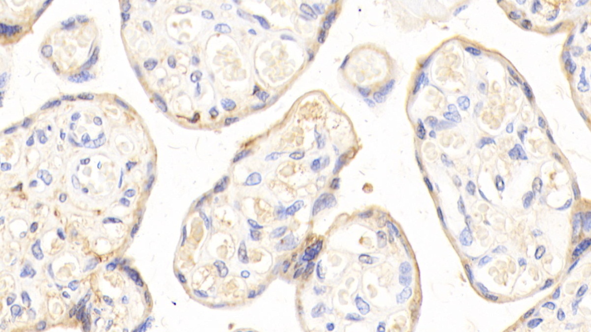 Polyclonal Antibody to Apolipoprotein H (APOH)