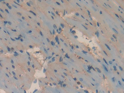 Polyclonal Antibody to Apolipoprotein H (APOH)