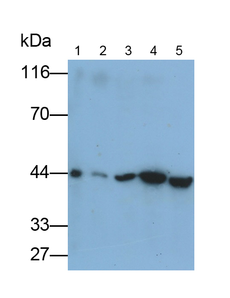 Polyclonal Antibody to Damage Specific DNA Binding Protein 2 (DDB2)