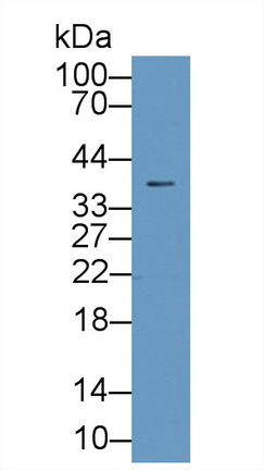 Polyclonal Antibody to Galectin 1 (GAL1)