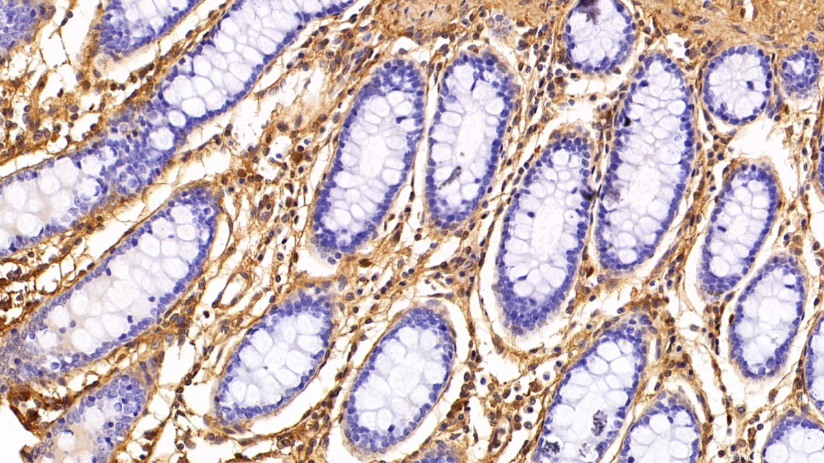 Polyclonal Antibody to Galectin 1 (GAL1)