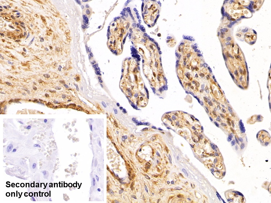 Polyclonal Antibody to Galectin 1 (GAL1)