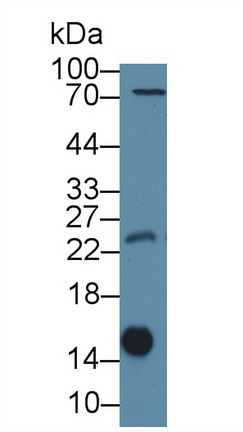 Polyclonal Antibody to Galectin 1 (GAL1)