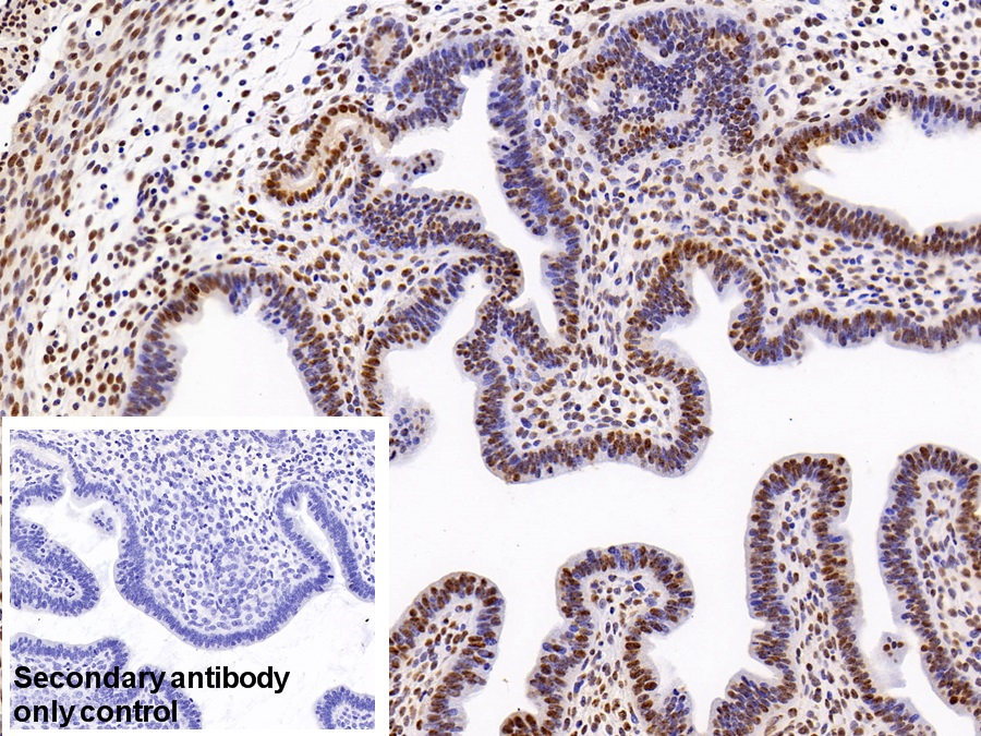 Polyclonal Antibody to Heterogeneous Nuclear Ribonucleoprotein A2/B1 (HNRPA2B1)