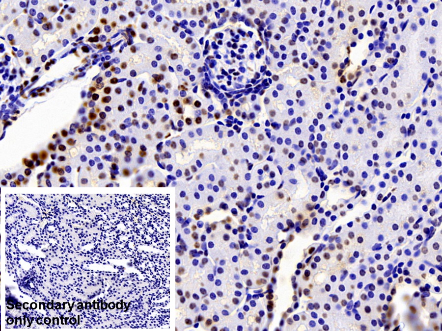 Polyclonal Antibody to Heterogeneous Nuclear Ribonucleoprotein A2/B1 (HNRPA2B1)