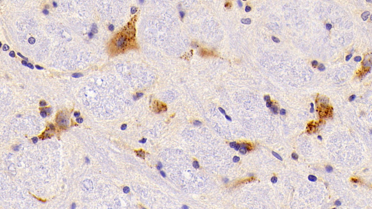 Polyclonal Antibody to Cathepsin A (CTSA)