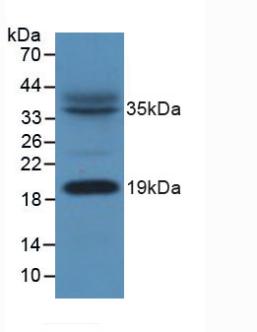 Polyclonal Antibody to Acyl Carrier Protein, Mitochondrial (ACP)