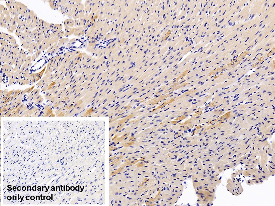 Polyclonal Antibody to Acyl Carrier Protein, Mitochondrial (ACP)