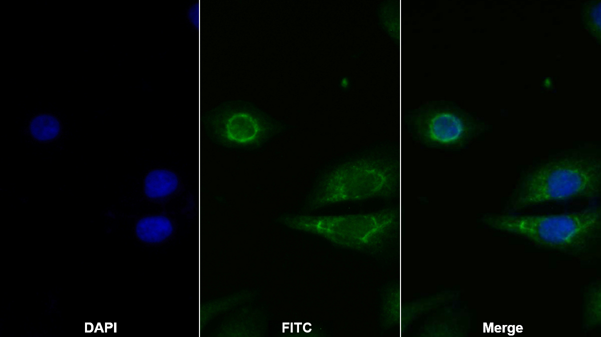 Polyclonal Antibody to Gelsolin (GSN)