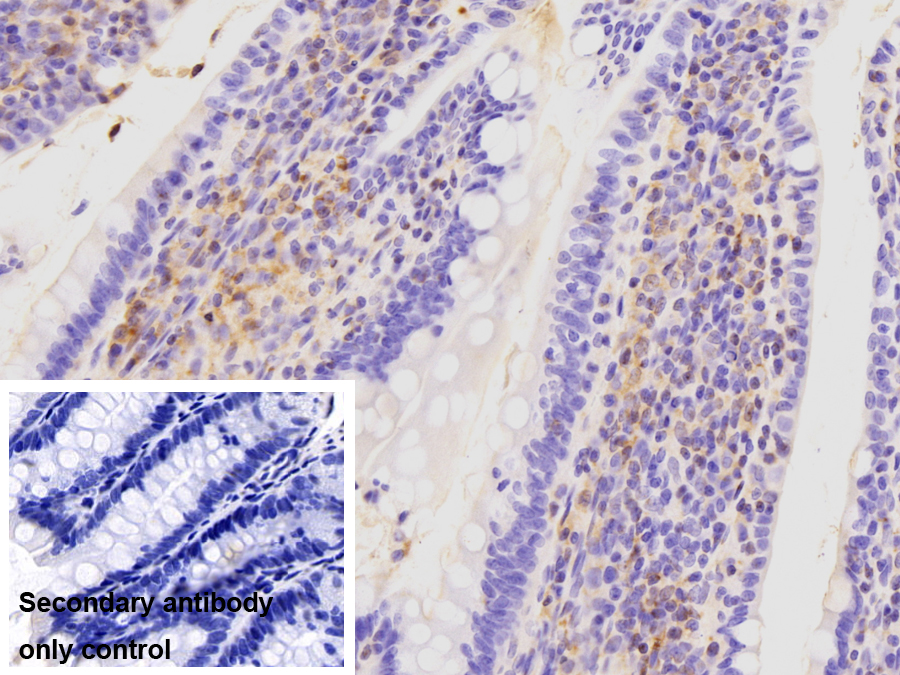 Polyclonal Antibody to Gelsolin (GSN)