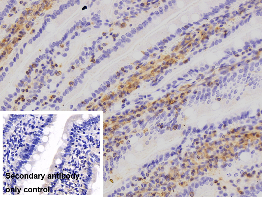 Polyclonal Antibody to Gelsolin (GSN)
