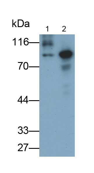 Polyclonal Antibody to Gelsolin (GSN)