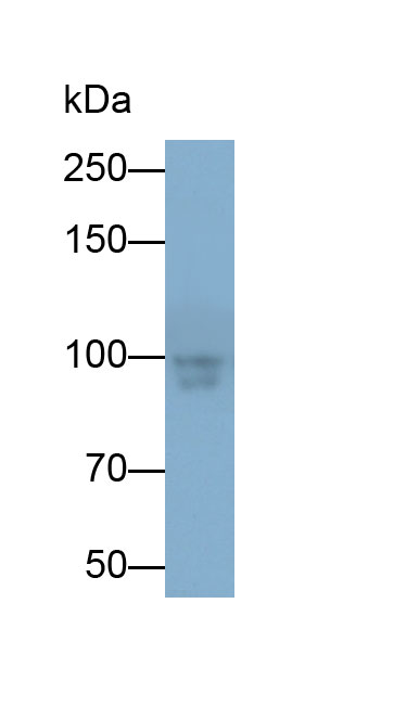 Polyclonal Antibody to Actinin Alpha 2 (ACTN2)