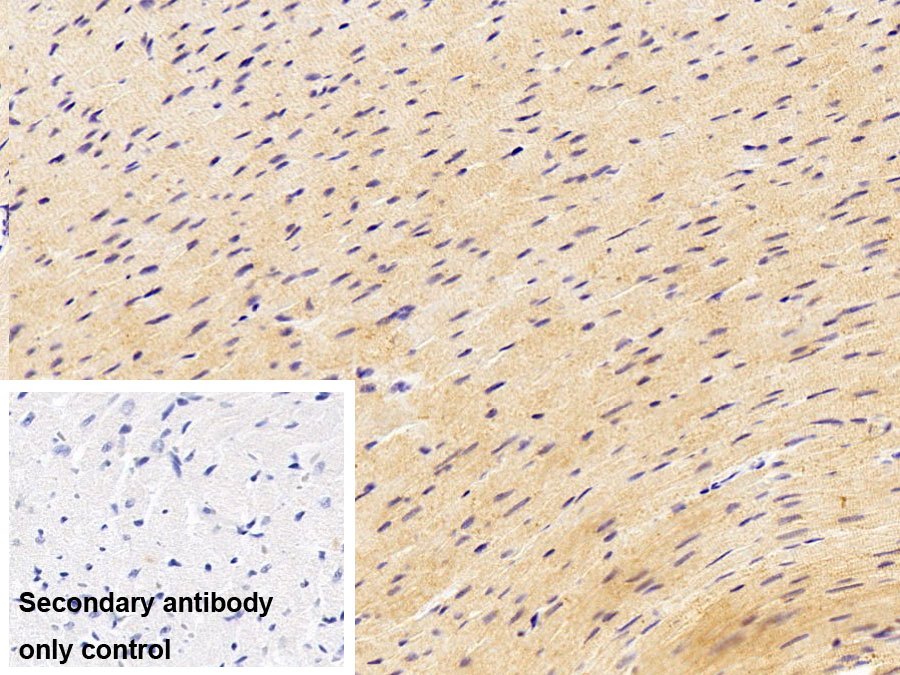 Polyclonal Antibody to Actinin Alpha 2 (ACTN2)