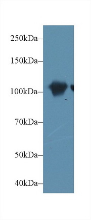 Polyclonal Antibody to Actinin Alpha 2 (ACTN2)