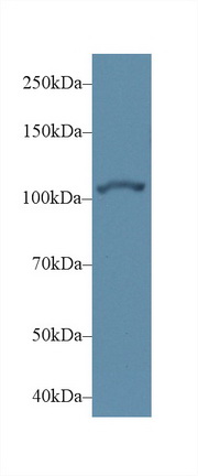 Polyclonal Antibody to Actinin Alpha 2 (ACTN2)