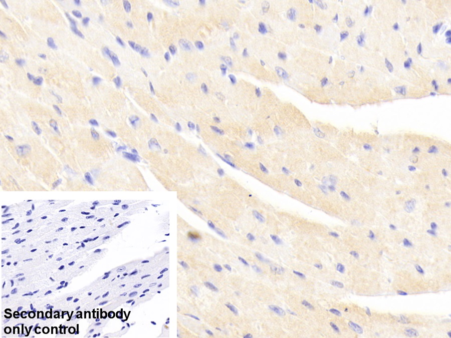 Polyclonal Antibody to Actinin Alpha 2 (ACTN2)