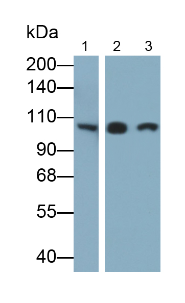 Polyclonal Antibody to Actinin Alpha 2 (ACTN2)